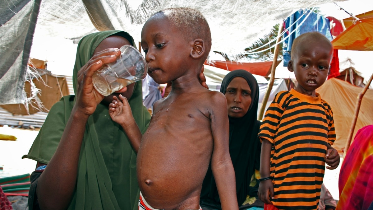 UN estimates 43,000 people have died from a severe drought in Somalia over the last year, says half of the deaths are children under the age of 5