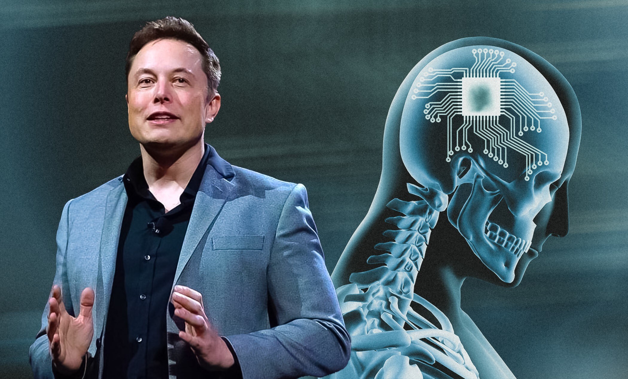 Elon Musk Says Neuralink’s First Human Implant Shows Promising Results
