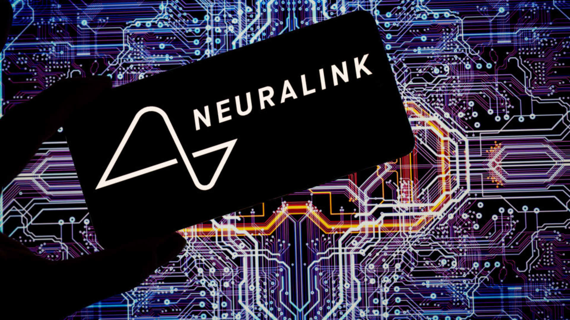 Neuralink Reports Malfunction in First Human Brain Implant