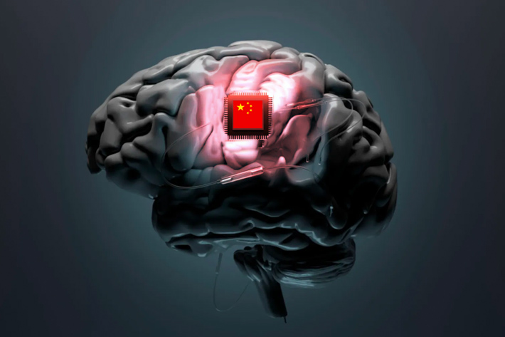 China Approves World’s First Brain-Computer Chip for Commercial Sale